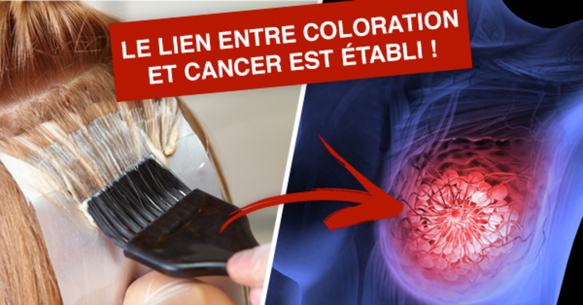 Des chercheurs établissent le lien entre coloration des cheveux et cancer