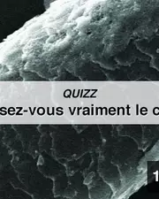 QUIZZ - Connaissez-vous vraiment le cheveu ?