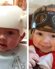 Décorations sur casque médical pour enfant !