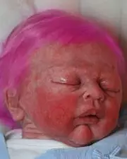 Scandaleux ! Elle colore les cheveux de sa fille de 2 mois, qui fait une réaction allergique !